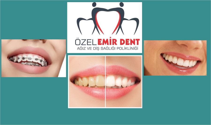 İmplant alanında bölgenin en iyisi Özel Emir Dent Ağız ve Diş Sağlığı polikliniği