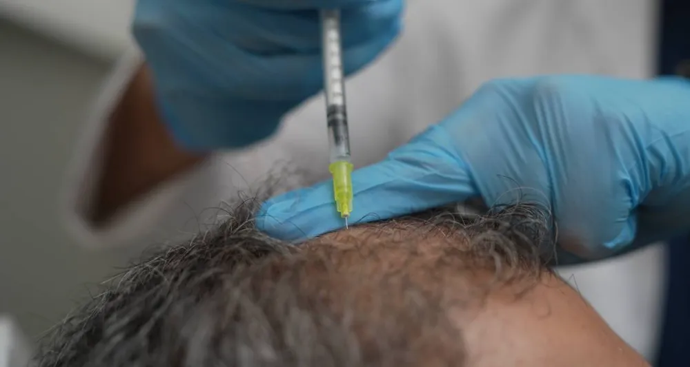 DÖKÜLEN SAÇLAR VÜCUDUN BİR ALARMI OLABİLİR