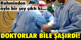 Rahminden çıkana doktorlar bile şaşırdı