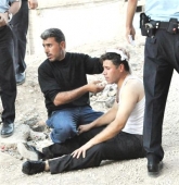 Kadınların Kavgasına Erkekler Karıştı;1 Yaralı 3 Gözaltı