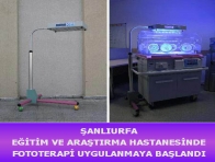 ŞANLIURFA EĞİTİM VE ARAŞTIRMA HASTANESİNDE FOTOTERAPİ ( IŞIK TEDAVİSİ ) UYGULANMAYA BAŞLADI