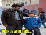 YÜZÜNDEKİ YANIK YÜZÜNDEN TOPLUM İÇERİSİNE ÇIKAMIYOR 